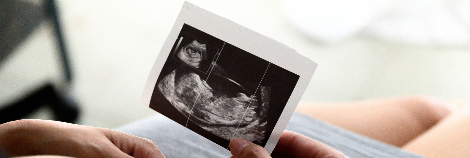 गर्भ में शिशु की हलचल कब शुरू होती है? जानें हर स्टेज का महत्व